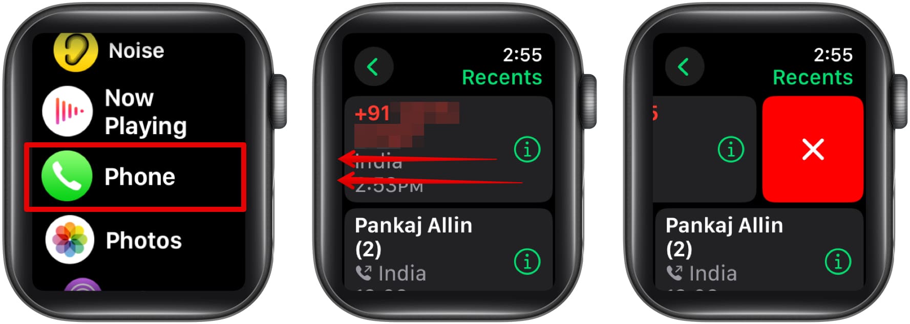 Deleting a recent call in the Phone app on an Apple Watch